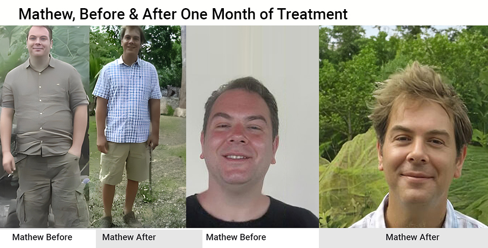 Mathew (Before and after one month of treatment)