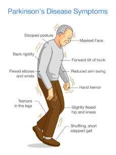 parkinson's disease symptoms